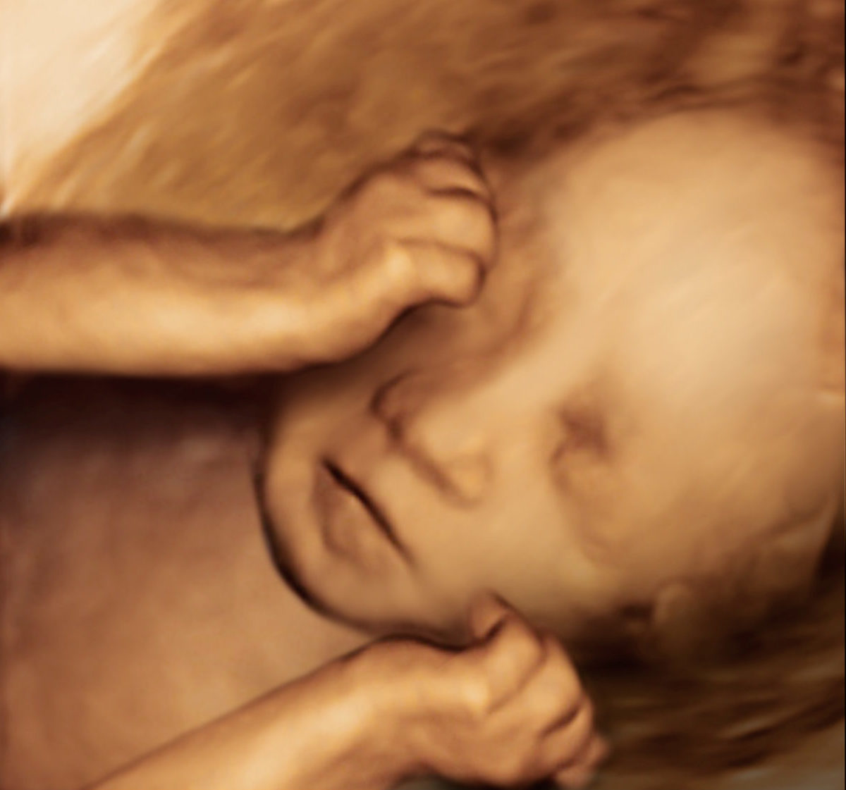 4D scan of IVF baby in womb
