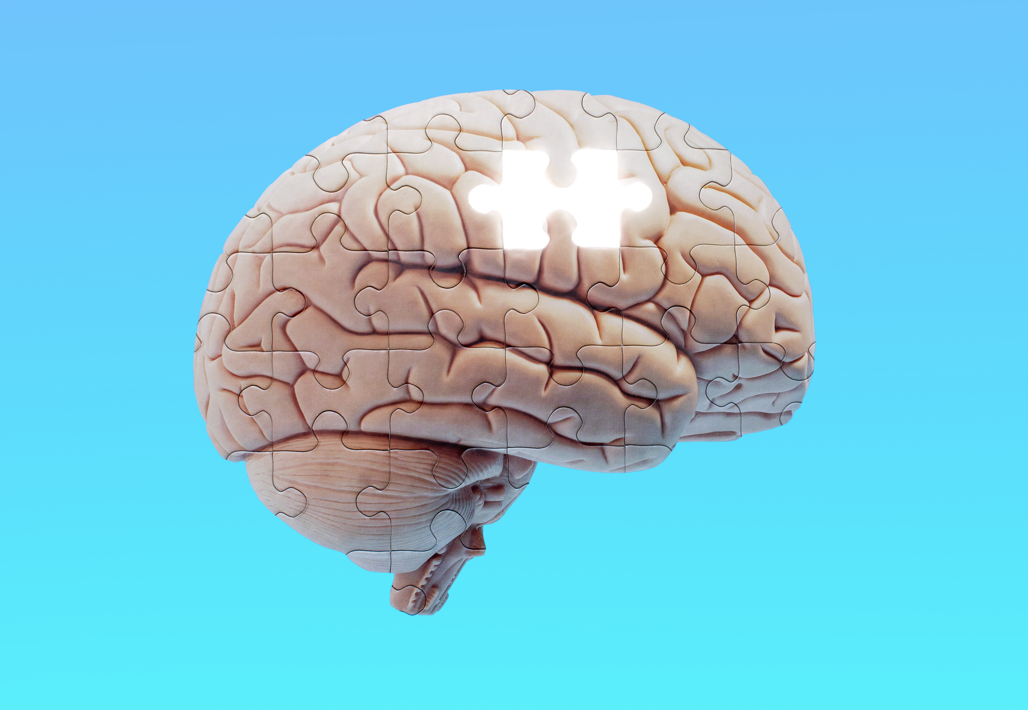 Brain puzzle missing a piece